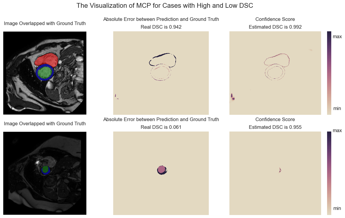../_images/demos_analysis_seg2d_27_0.png