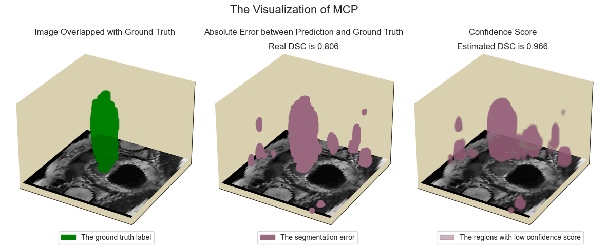 ../_images/demos_analysis_seg3d_23_0.png